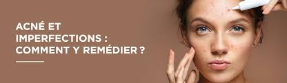 Dites Adieu à l'Acné pour Toujours!